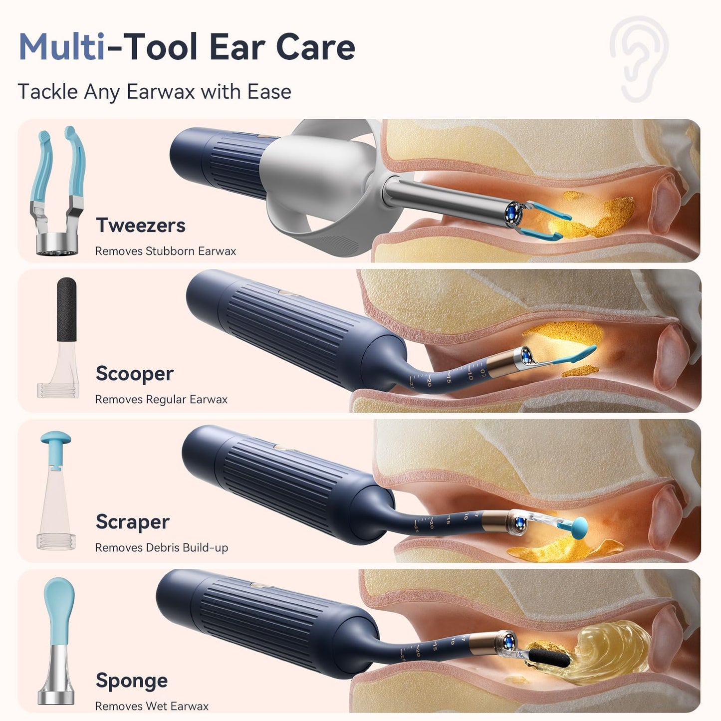 TCVOR Professional Ear Wax Removal Kit with Camera - 1080P HD Visual Ear Cleaner with Tweezers/Scooper/Scraper/Sponge/6 LED Lights Flexible Ear Otoscope - Portable Earwax Removal Tool for Home Use